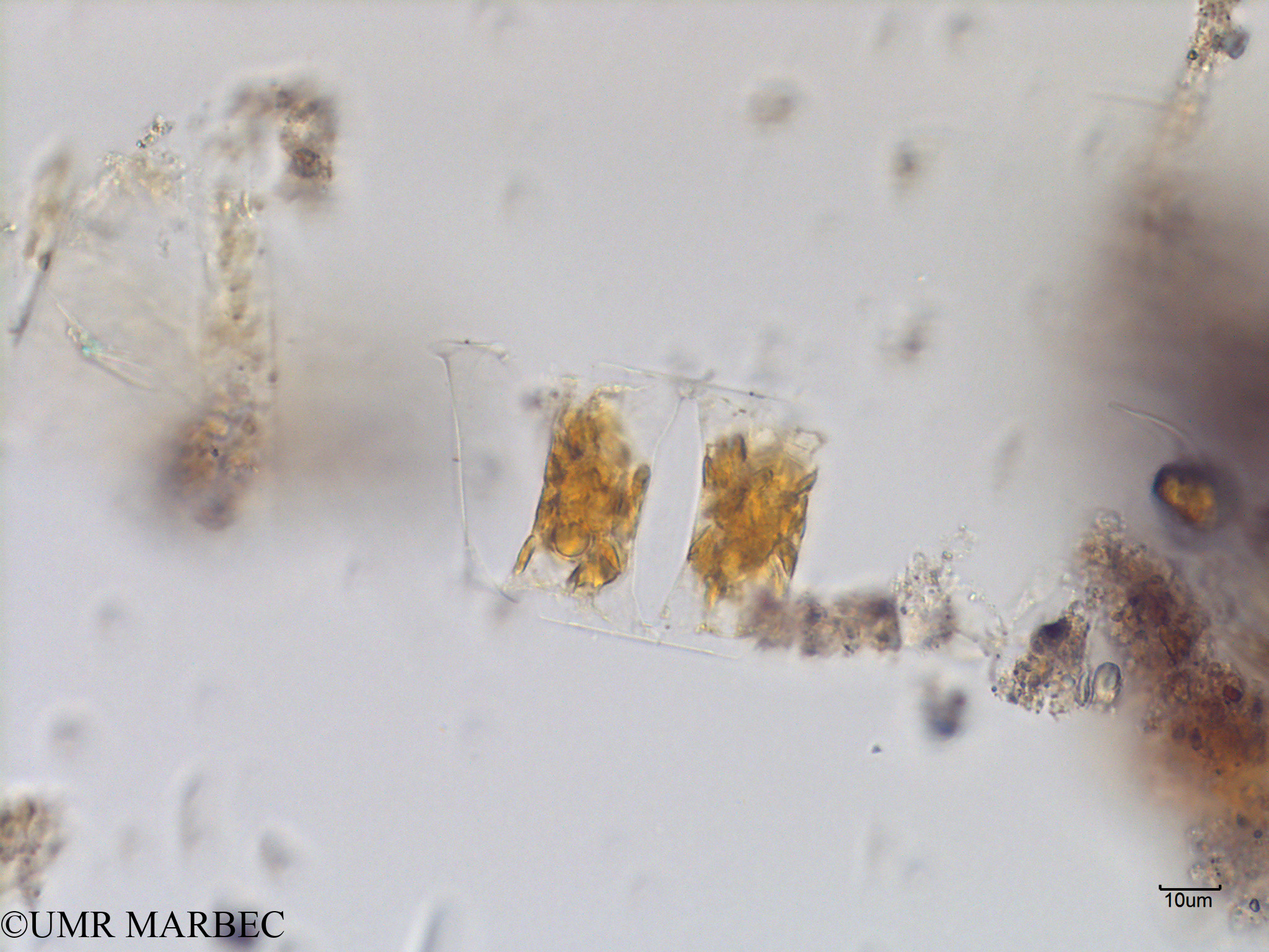phyto/Scattered_Islands/mayotte_lagoon/SIREME May 2016/Hemiaulus membranaceus (MAY4_cf eucampia-3).tif(copy).jpg